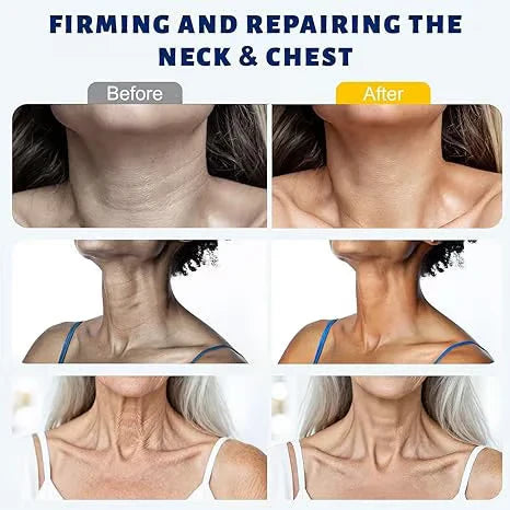 FirmSkin Neck™ - Crema Collo al Collagene e Acido Ialuronico