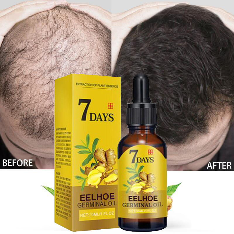 Ginger Hair | Oil for Hair Growth and Treatment of Baldness | Elegantiee