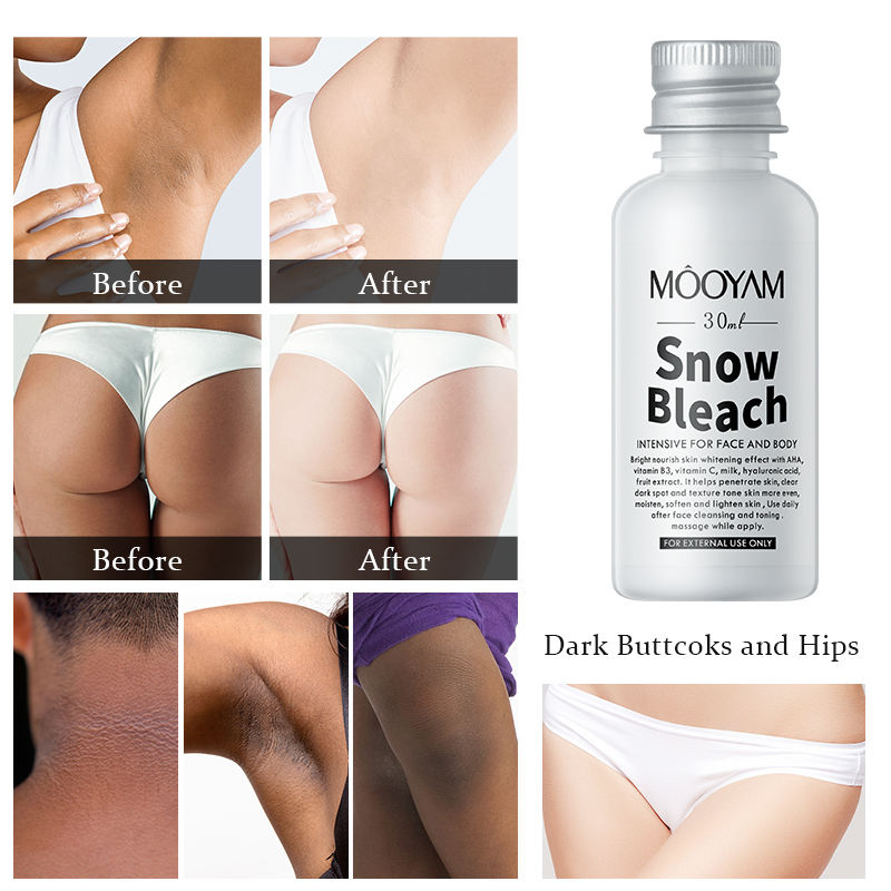SnowBleach™️| Crema sbiancante per il corpo