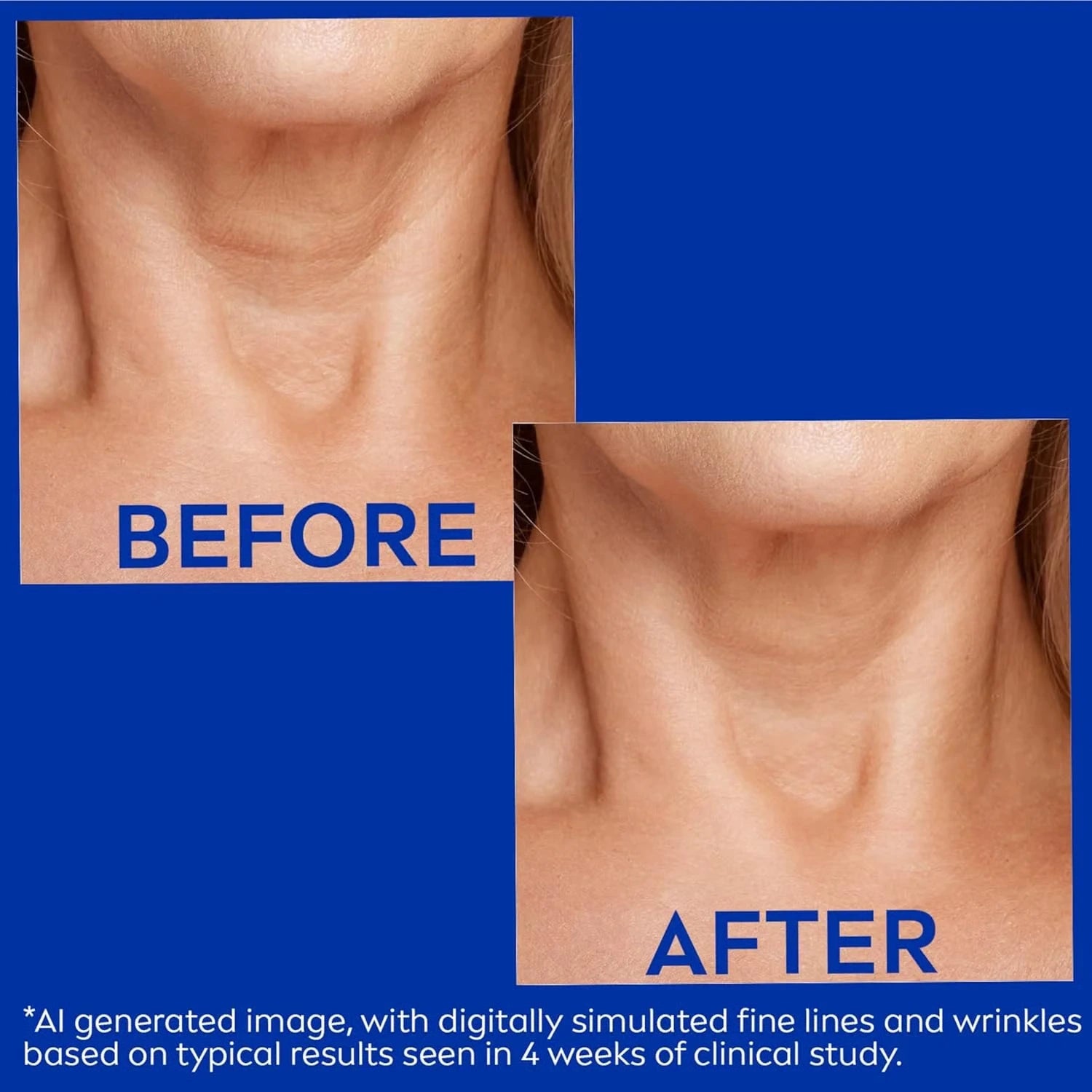 FirmSkin Neck™ - Crema Collo Collagene e Acido Ialuronico | ELEGANTIEE