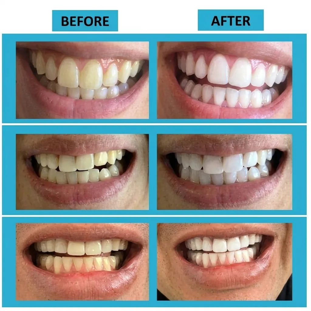 Polvere sbiancante e pulente per denti | Elegantiee