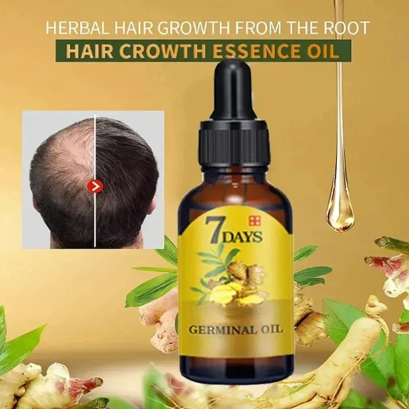 Ginger Hair | Oil for Hair Growth and Treatment of Baldness | Elegantiee
