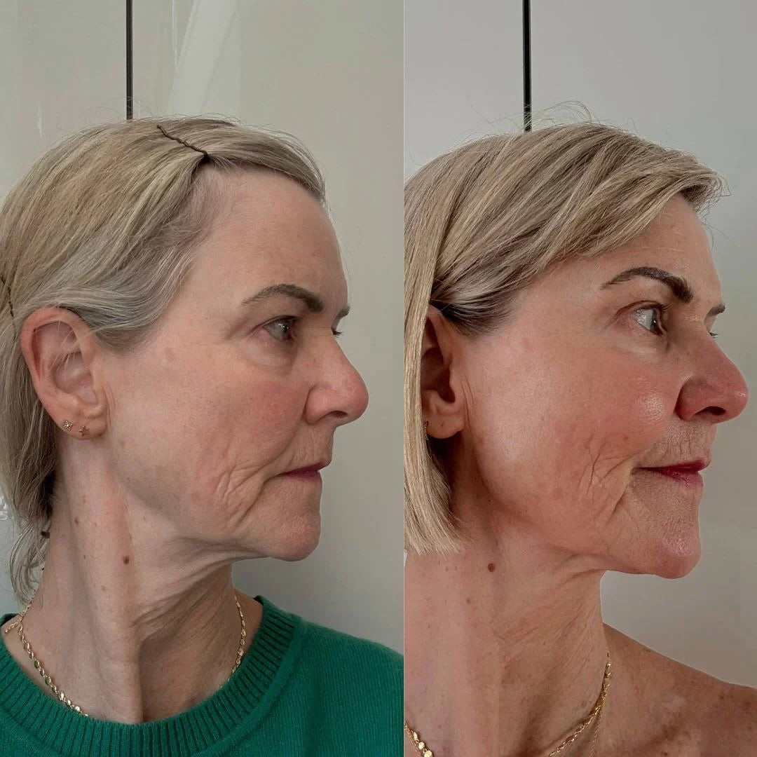 Crema Lifting Antietà Gua Sha | Elegantiee