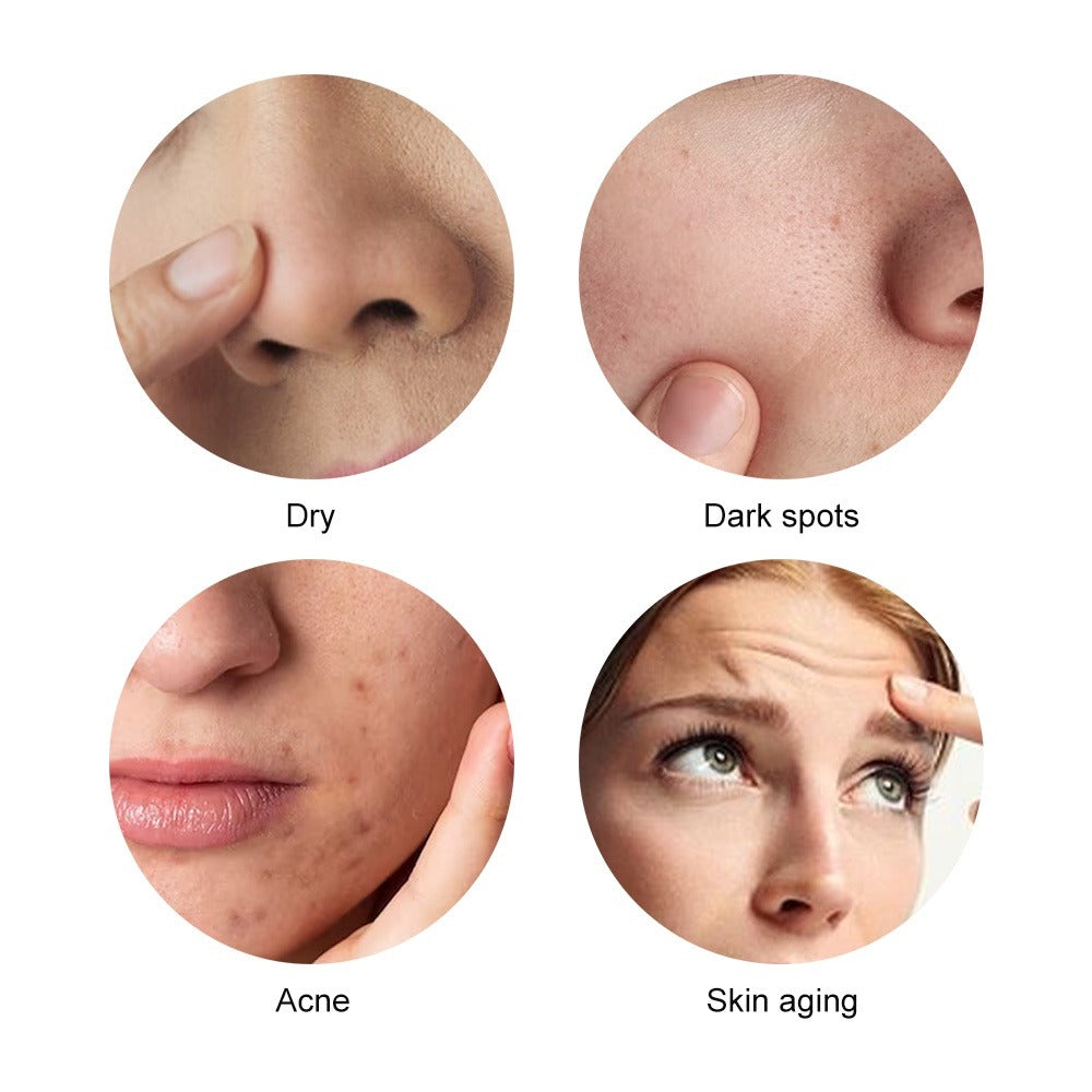 Dispositivo portatile per ultrasuoni HIFU UltraSkin Lift™ - ELEGANTIEE