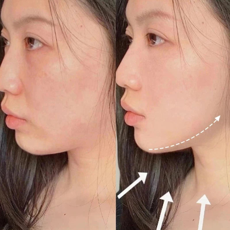 V-Revita™ - Maschera Viso per Ridurre il Doppio Mento e le Rughe | Elegantiee
